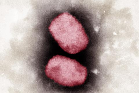 So sehen Affenpocken-Viren unter dem Elektronenmikroskop aus. Foto: dpa