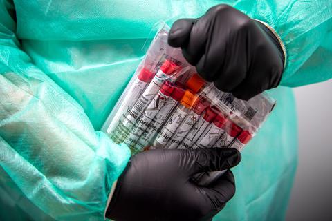 Proben für einen PCR-Test werden von einem Mitarbeiter im Corona-Testzentrum verpackt. Foto: Sina Schuldt/dpa