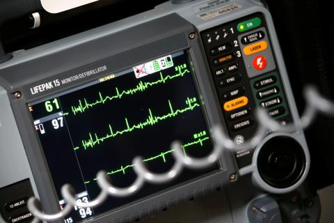 Auf dem EKG-Gerät ist Vorhofflimmern zwar gut erkennbar, doch da es häufig unregelmäßig auftritt, ist die Diagnose eher schwierig. Eine neue App macht die Früherkennung leichter.         Archivfoto: dpa