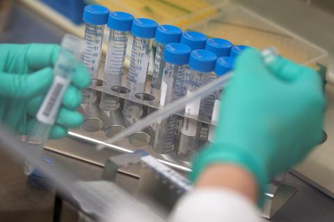 Eine Mitarbeiterin des Landesgesundheitsamts Baden-Württemberg pipettiert Corona-Proben.  Foto: dpa/Marijan Murat