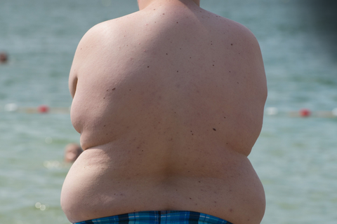 Übergewicht, vor allem massives, kann der Gesundheit schaden. Aber abnehmen ist nicht für jeden einfach. Foto: Sebastian Kahnert/dpa-Zentralbild/dpa